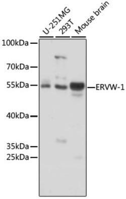 Carbonic Anhydrase II/CA2 Rabbit anti-Human, Mouse, Polyclonal, Novus Biologicals